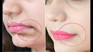 This 1Minute Technique will Remove Mouth Wrinkles amp Lift Corners Of Your Mouth Instantly [upl. by Templas]