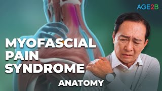 Myofascial Pain Syndrome  How to RELIEVE TRIGGER POINTS  Treatments Animation [upl. by Rossner]