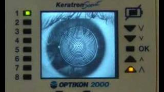 The eye through a corneal topographer [upl. by Hpsoj]