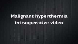 Malignant Hyperthermia Intraoperative video  Case Report [upl. by Aicirtac226]