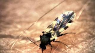 Midge bites through presenters arm  The Secret Life of Midges  BBC One [upl. by Gilman840]