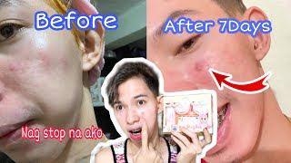 G21 Swipe Right Rejuvenating Kit  Tinigil kona ang pag gamit  7Days Review [upl. by Neliac]