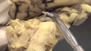 Cranial Nerves Sheep Brainmov [upl. by Halette440]