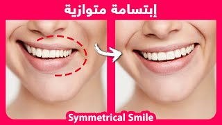 How to naturally fix smile asymmetry [upl. by Kernan]