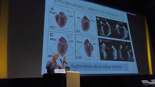 Avantages de lEchographie TransOesophagienne ETO  Dr YVAN PHILIP [upl. by Annonyw]