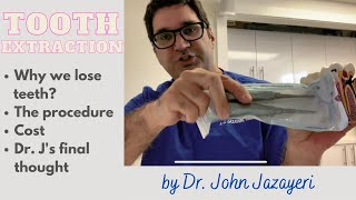 Tooth Extraction What You Need to Know Before You Pull Your Tooth [upl. by Christabel]