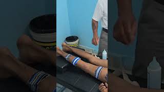 Tens therapy sciatica muscle pain [upl. by Patt]