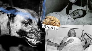 The TERRIFIC History of rabies [upl. by Dat]