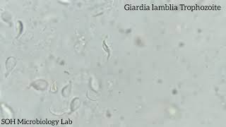 Giardia lamblia Trophozoite in stool [upl. by Ramberg]