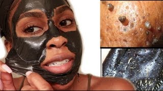 EASY Blackhead and Whitehead Remover Peel Off Mask [upl. by Alleul]