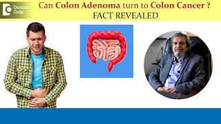 Can Colon Adenoma turn to Colon Cancer  Colon Polyp Removal Dr Rajasekhar M R  Doctors Circle [upl. by Oeramed]