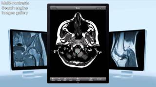 eAnatomy IMAIOS on iPad [upl. by Tatman]