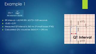 How to properly calculate a Qtc [upl. by Amary]