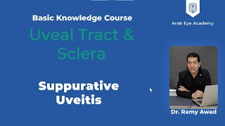 Lecture 9 Uveal tract and sclera Part 3 Suppurative uveitis special types of uveitis [upl. by Llerraj]