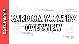 Cardiomyopathy Overview  types dilated hypertrophic restrictive pathophysiology and treatment [upl. by Drews538]