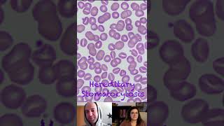 Hereditary Stomatocytosis Morphology Characteristics [upl. by Quince]