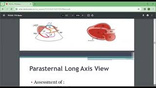 ECHOCARDIOGRAMTRANSTHORACIC ECHO COMMON ECHO WINDOWS AND VIEW [upl. by Rennane989]