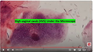 HVS under the microscope [upl. by Reamy]