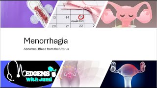 Menorrhagia Never let heavy periods stop you Heres Top 7 causes that require your attention [upl. by Buhler]