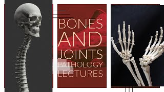 BONES AND JOINTS PATHOLOGY lecture 8 OSTEOSARCOMA important topic made easy [upl. by Zackariah]