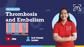 Thrombosis and Embolism with Dr Priyanka Sachdev [upl. by Tterab678]