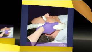 Syneron Laser Repair [upl. by Jeffy]