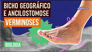 ANCILOSTOMOSE E BICHO GEOGRÁFICO tipos de verminoses  Resumo de Biologia Enem  Cláudia Aguiar [upl. by Zippel]