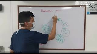 Pneumocystis Jirovecii  Dr Jeffersson Moreno [upl. by Chouest]