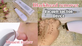 How to use blackhead remover  Acne pore cleaner Vacuum remover [upl. by Alden]