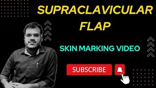 SUPRACLAVICULAR FLAP SKIN MARKING [upl. by Ijat284]