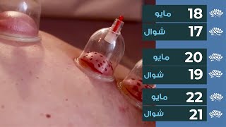 Hijama Cupping Therapy  Sunnah Days  May 18 20 22 2022  Lotus Holistic Medical Center [upl. by Eycats]