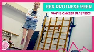 WAT ALS 1 BEEN VEEL KORTER IS DAN DE ANDERE  TOPDOKS EXTRA [upl. by Zuleika]