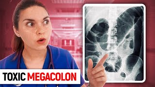 Day in the Life of a DOCTOR Hospital Vlog TOXIC MEGACOLON [upl. by Higley]