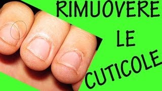 COME RIMUOVERE LE CUTICOLE Sos unghie 9 [upl. by Alfons]