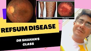 Refsum Disease  Retinitis Pigmentosa  Anosmia  Neuropathy [upl. by Euqinahs]