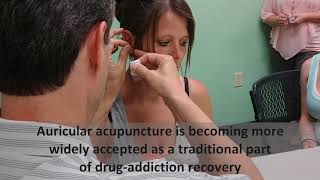 Auricular acupuncture [upl. by Service543]