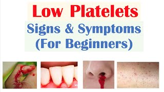 Low Platelets Signs amp Symptoms Basics for Beginners [upl. by Vallery]