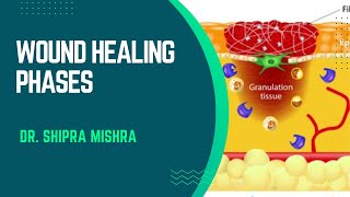 Wound Healing Phase step by step in easy way  Dr Shipra Mishra [upl. by Nappie705]