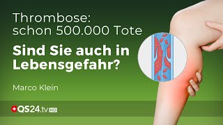 Thrombose – Prophylaxe und Behandlung  Kleinsche Felder  Marco Klein  QS24 Gesundheitsfernsehen [upl. by Eicyac]