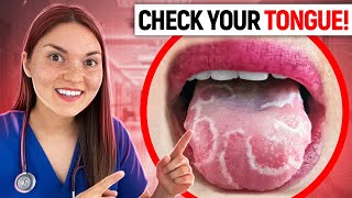 What your TONGUE says about your HEALTH Doctor Explains [upl. by Ahsinyar]