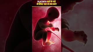 गर्भ में बच्चे के गले में placenta लिपट जाए तो क्या करे👼❗ [upl. by Assyn880]