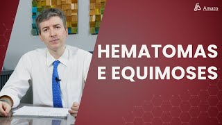 Roxos nas pernas Hematomas Equimoses e Petéquias [upl. by Ahsilla]