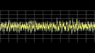 Influenza also Colds  Rife Frequencies [upl. by Eanad]