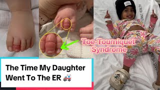 The Time My Daughter Went To The ER Toe Tourniquet Syndrome parent toddlers funny goodjobdad [upl. by Hsirk553]