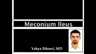 Meconium Ileus [upl. by Tyson]