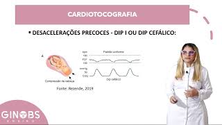 Aprenda a interpretar a cardiotocografia [upl. by Adlay]