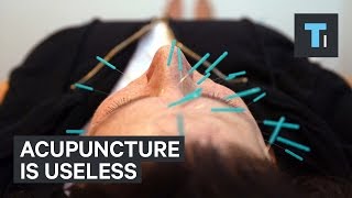 Acupuncture is useless [upl. by Lucho35]