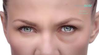 Remescar Eye Bags amp Dark Circles TV Spot [upl. by Dunston780]