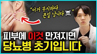 거울 속 내 피부 모습에 이것들이 보인다면 우리 몸이 보내는 당뇨 신호입니다  당뇨병 전조증상 인슐린 [upl. by Eihcir]