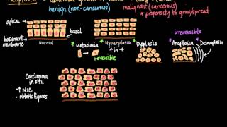 Neoplasia [upl. by Oleic]